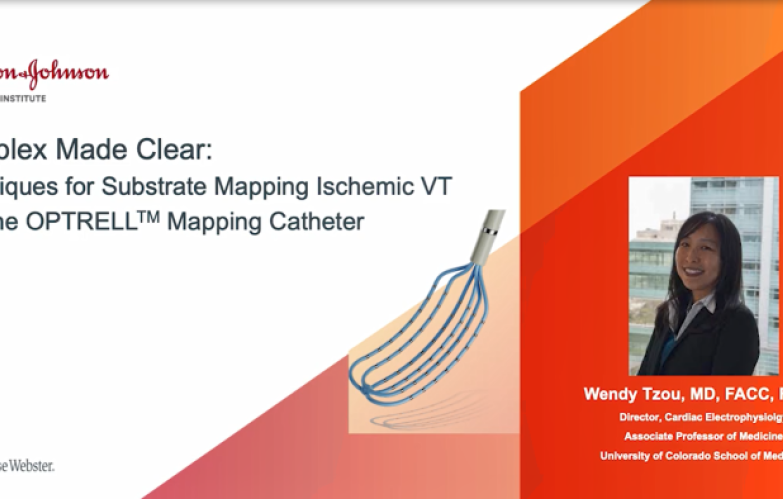 An Image From "Techniques for Substrate Mapping Ischemic VT with the OPTRELL Mapping Catheter"