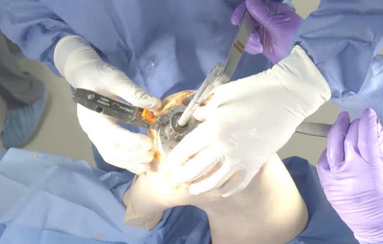 ATTUNE® Revision Fixed Bearing Knee System with Tibial Press Fit Stem by Brian Haas, MD
