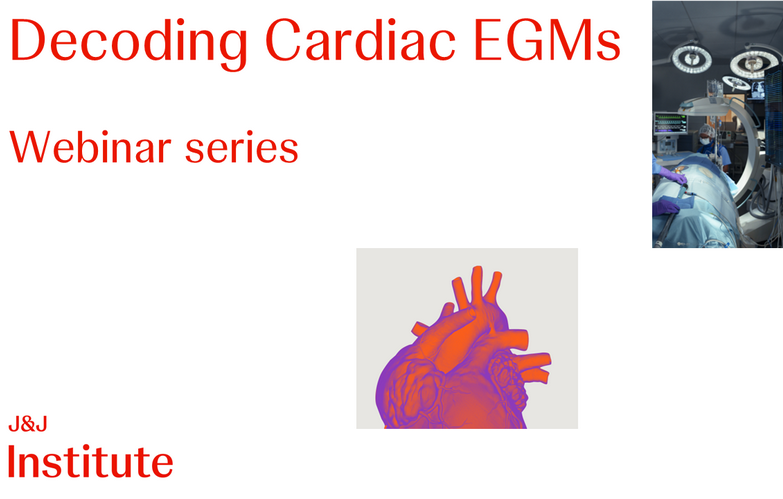 Decoding cardiac EGMs
