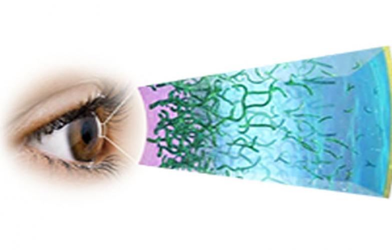 An image of the "All About Dry Eye Part 1 - Relevant Anatomy, Tear Film & Physiology" external link on JJI.com
