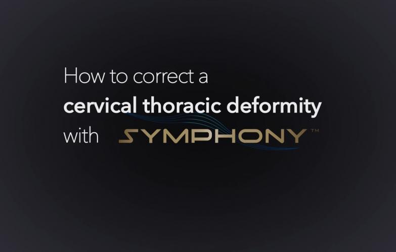 An image from the "Correcting a Cervico-Thoracic Deformity using the SYMPHONY™ OCT System with Dr. Christopher Ames & Dr. Joseph Osorio" playlist on the JnJInstitute.com playlist.
