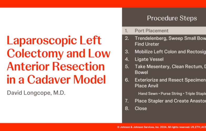 An Image From "An Image From " Laparoscopic Left Colectomy and Low Anterior Resection in a Cadaver Model with David Longcope, MD"