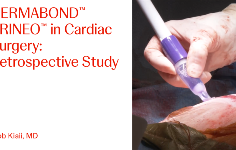 An Image From "DERMABOND™ PRINEO™ in Cardiac Surgery: Retrospective Study with Bob Kiaii, MD"
