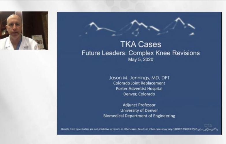 An image from the "Future Leaders Complex Revision Knees ArthroTopic" video on the JnJInstitute.com website.