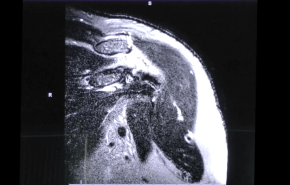 Surgeon's approach to Reading an MRI - Stephanie Muh, MD thumbnail