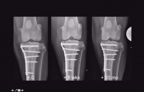 An image from the "Plating Advancements for Fracture Fixation with Michael P. Kowaleski DVM, DACVS, DECVS" video on the JnjInstitute.com website.