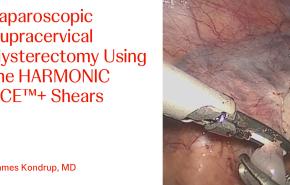 An image of the "Laparoscopic Supracervical Hysterectomy using HARMONIC ACE+ with James Kondrup, MD" video on the JnJInstitute.com website.