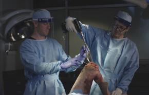 An Image From "ATTUNE Revision Knee System: Procedural Workflow with Cones - Timothy Alton, MD