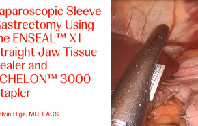 An Image From "Laparoscopic Sleeve Gastrectomy Using the ENSEAL™ X1 Straight Jaw Tissue Sealer and ECHELON™ 3000 Stapler with Kelvin Higa, MD"
