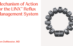 An Image From "Mechanism of Action for LINX with Tom DeMeester, MD"