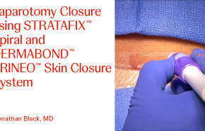An Image From "Laparotomy Closure using STRATAFIX™ Spiral and DERMABOND™ PRINEO™ Skin Closure System with Jonathan Black, MD"