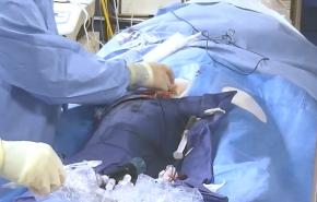 An image of the "Utilizing Intracardiac Echo During Transseptal Puncture with Brett Gidney, MD" video on the JnJInstitute.com website.