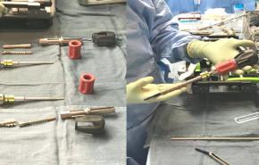 An image of the "Minimally Invasive Surgery (MIS) & Driving OR Efficiency with Joshua Abrams, DO" video.
