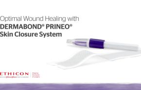 An image from the "Reducing Wound Drainage with New Skin Closure Systems by Liza Ovington, MD" video on the JnJInstitute.com website.