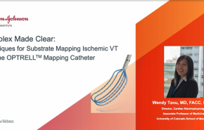 An Image From "Techniques for Substrate Mapping Ischemic VT with the OPTRELL Mapping Catheter"
