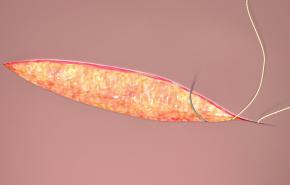 An image of the "Step-by-Step Suture Techniques" video.