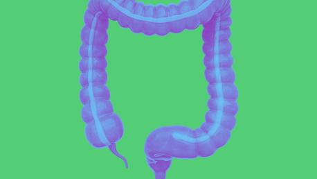 Laparoscopic Low Anterior Resection