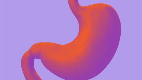Laparoscopic Roux-en-Y Gastric Bypass 