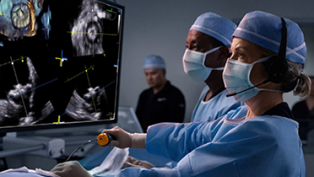 ICE in Structural Heart Image