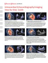 An image from the "ICE Catheter Imaging Manipulation Guide" document on the JnJInstitute.com website.