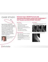 An image from the "Case Study: Extension Injury (AO B3 Fracture) with Ankylosing Spondylitis treated with SYMPHONY™ OCT System & MULTIPOINT SECURE™ with Richard Bransford, MD" PDF on the JnJInstitute.com website.