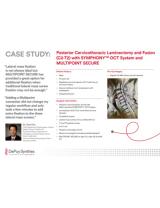 An image from the "Posterior Cervicothoracic Laminectomy & Fusion (C2-T2) with SYMPHONY™ OCT System & MULTIPOINT SECURE with Paul Kim, MD" PDF on the JnJInstitute.com website.