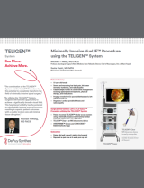 An Image From "Minimally Invasive VueLIF Procedure using the TELIGEN™ System - Michael Y. Wang, MD"