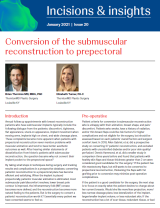 An Image From "Conversion of the Submuscular Reconstruction to Prepectoral with Brian Thornton, MD & Elizabeth Turner, PA-C."