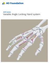 An image from the "AOTK System Innovations - Variable Angle Locking Hand System" document on the JnJInstitute.com website.