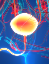 Bacillus Calmette—Guérin- Unresponsive Non—Muscle Invasive Bladder Cancer with Carcinoma In Situ (BCG-UR NMIBC CIS)