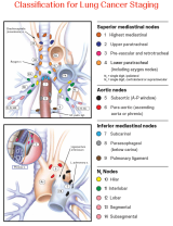 An Image From "Regional Lymph Node Classification for Lung Cancer Staging"