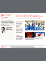 Image from Minimally invasive Hemilaminectomy with Microdiscectomy using the TELIGEN™ System with Christopher Ahuja, MD