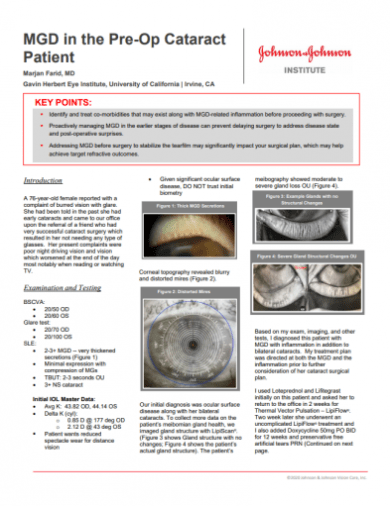 case study of cataract patient