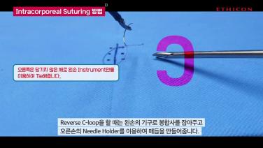 LAP Intracorporeal Suturing (A to Z)