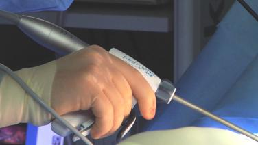 An image from the "Gastric Sleeve with Power Echelon and STRATAFIX with Stephen Scott, MD" video on the JnJInstitute.com website.