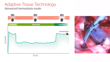an image of the "HARMONIC ACE+7 Advance Hemostasis in Full Cycle Transection" video on the JnJInstitute.com website.