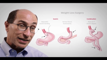 An Image From "Types of Bariatric Surgery with Lee Kaplan, MD"