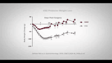 An Image From "VSG vs. Sham Procedure with Randy Seeley, MD"