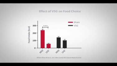An Image From "Impact of a Vertical Sleeve Gastrectomy on Food Selection"