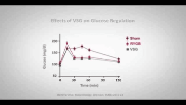 An Image From "Effects of Bariatric Surgery on Glucose Regulation with Randy Seeley, MD"