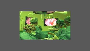 An image of the "Right Upper Lobectomy Demonstration with Robert McKenna, MD" video.