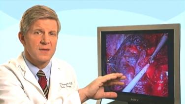 VATS Left Lower Lobectomy with Scott Swanson, MD