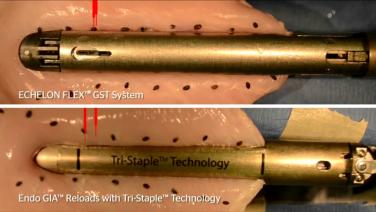 An image of the "ECHELON FLEX™ GST System & Tri-Staple Tissue Flow Comparison" video on the JnJInstitute.com website.