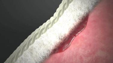 An image of the "EVARREST Fibrin Sealant Patch - Mechanism of Action" video.