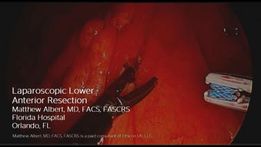 An image of the "Laparoscopic Lower Anterior Resection with Matthew Albert, MD" video.