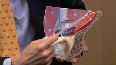 An image from the "Anatomy Review for Laparoscopic Inguinal Hernia Repair with Kent Kercher, MD" video on the JnJInstitute.com website.