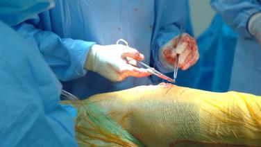 Total Hip Arthroplasty Procedure Video with Ryan Nunley, MD