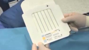 An image of the "Laparoscopic Inguinal Hernia - TAPP using ULTRAPRO ADVANCED™ with Tim Tollens, MD" video.