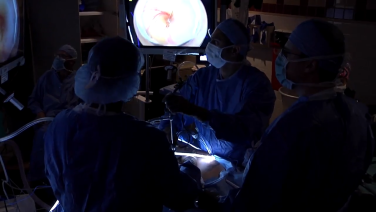 Complete Mesocolic Excision in a Left Hemicolectomy by Dipen Maun, MD