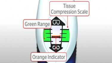 An image displaying a "Tissue Compression Scale".